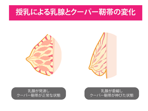 バストが大きく変化する卒乳後は プチ胸さんも 垂れ胸 に その原因とは インナーガイド Heaven Japan