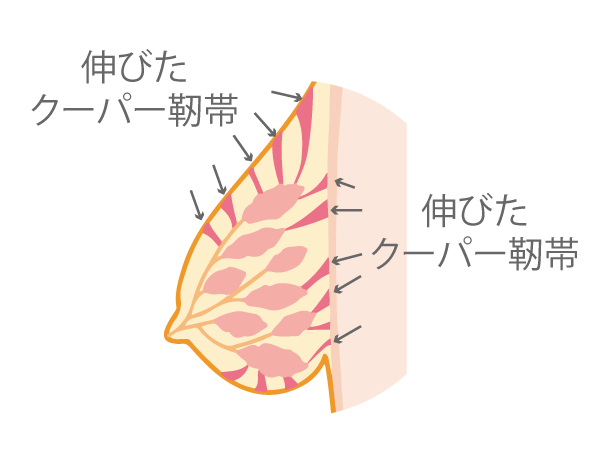 バストが大きく変化する卒乳後は プチ胸さんも 垂れ胸 に その原因とは インナーガイド Heaven Japan